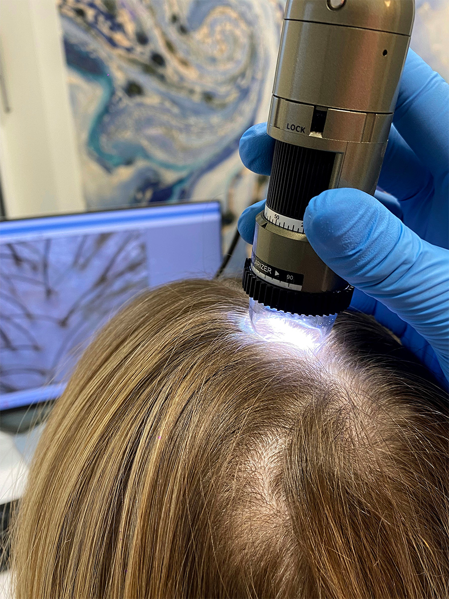 Trychologia: Odkryj tajemnice zdrowej skóry głowy i włosów